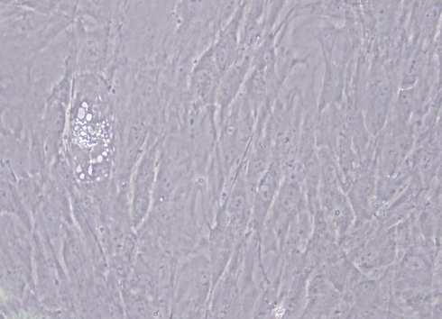 83 A B Şekil 4.25: Yağ dokusundan izole edilen hücrelerin adipojenik farklılaşma sırasında mikroskobik görünümü, ok lipid granülü oluşturan farklılaşmaya başlamış bir hücreyyi göstermektedir (24.