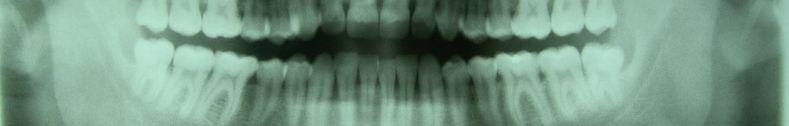 radyografilerde mandibular kemiğin yoğunluğunu tespit