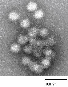 Norovirüsler norovirüs, sapovirüs ve nebovirüs olmak üzere 5 genusdan oluşmaktadır.