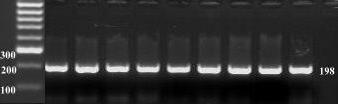 67 4.2. MTHFR C677T Polimorfizmine Ait RFLP Sonuçları MTHFR genindeki polimorfizmin belirlenmesi amacıyla PZR-RFLP analizleri yapılmıştır. MTHFR geninin 4. ekzon bölgesi çizelge 3.