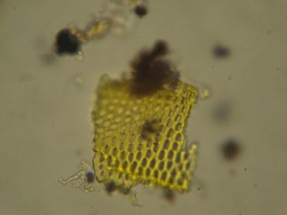 radix tozu mikroskobik