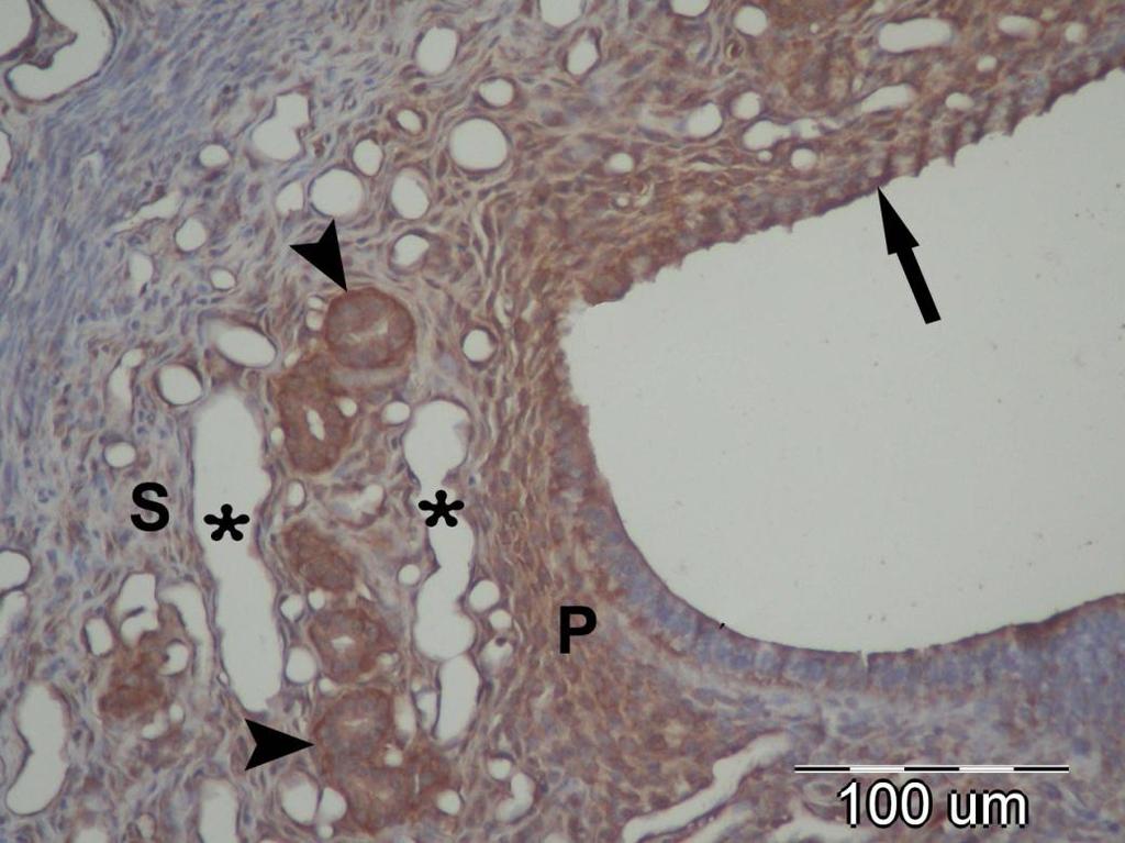 Diyabet 5. günde tüm bölgelerdeki luminal epitel hücrelerinin bir kısmında iģaretlenme görülürken diğer kısmında iģaretlenme gözlenmedi. Endometriyal bez epitelinde ekspresyon yine kuvvetliydi.