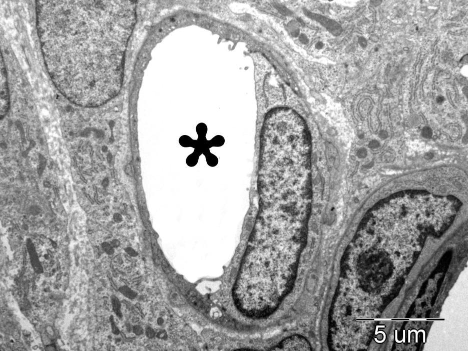 Şekil 4.2.4. Kontrol grubu 3. günde stromadaki normal görünümlü kapiller damar (yıldız) (X7,500). Kontrol 5. günde luminal epitel hücreleri 3. güne göre daha kısa ve az sayıda mikrovilluslara sahipti.