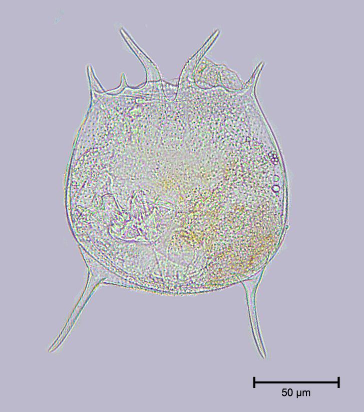 Asplanchna priodonta (Rotifera)