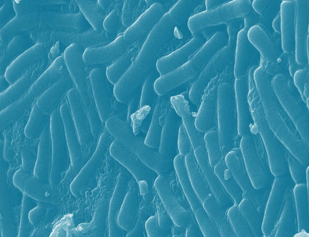 Bifidobacterium bifidum Bifidobacterium infantis Bifidobacterium lactis