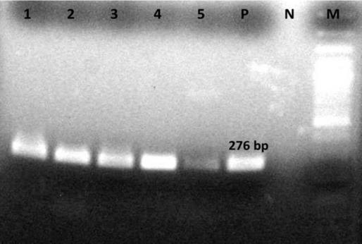 Isparta ve Burdur İlleri Üretim Alanlarında Yetiştirilen Domateslerde Domates Lekeli Solgunluk Virüsü nün Tanılanması Şekil 3. TSWV için uygulanmış RT- PCR sonuçları (M.