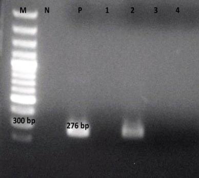 Mersin ve çevresinde yetiştirilen domateslerde zararlı yeni bir virüs: Tomato spotted wilt virus. Türkiye VII. Fitopatoloji Kongresi, Eylül 26-29, 1995, Adana, Türkiye, Kongre Kitabı, 303-305.