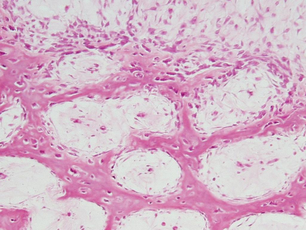 Bu tür kemikleşme şöyle olaylanır. Önce mezenkim hücreleri yer yer hızla bölünerek osteoprogenitor hücrelere, bunlarda hızla bölünerek osteoblastlara dönüşürler.