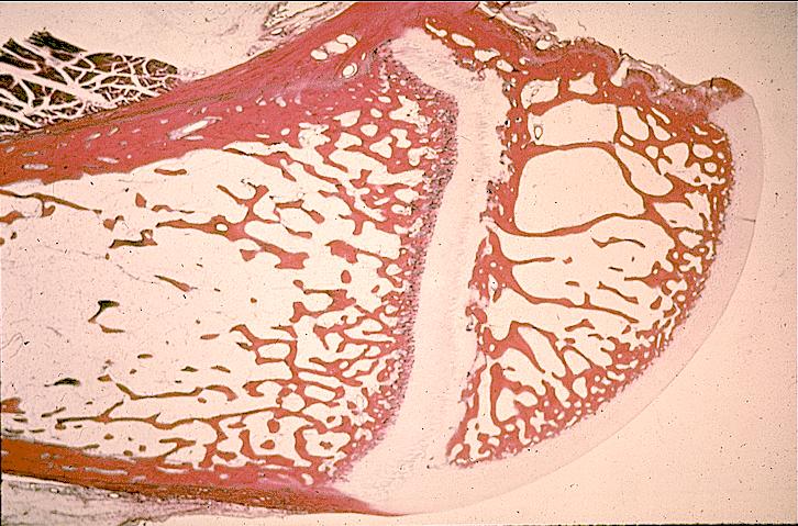 Epifizyal plak kıkırdağı diyafiz yönünde devamlı mitozla çoğalır, çoğalan hücreler kemiğe dönüşür, böylece kemiğin uzaması sağlanır.