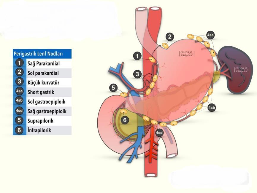 4 Lenfatikler, damarları takip ederek 4 primer nodal bölge oluşturur: 1) Sağ gastroepiploik damarların çevresinde bulunan lenfatikler.
