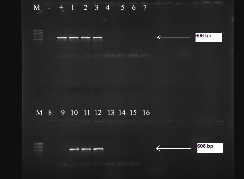 The primers amplifying IroB gene used for PCR Primer Sekans Primer 1 5 -TGCGTATTCTGTTTGTCGGTCC-3 Primer 2 5 -TACGTTCCCACCATTCTTCCC-3 PCR 50 µl lik karışım haciminde, 0.