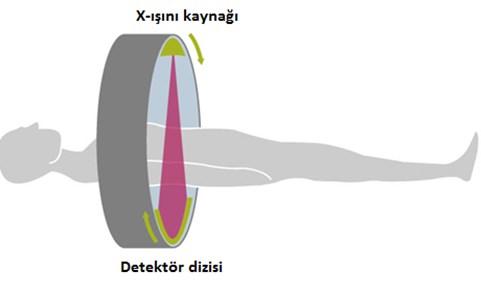 Radyografik görüntülemede hastanın bir tarafında X-ışını kaynağı diğer tarafında genellikle düzlemsel bir dedektör yer alır.
