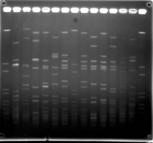 Duman Y, Tekereko lu MS, Otlu B. Şekil 2. PFGE sonrası DNA bant görüntüleri. with mathematical averaging (UPGMA) kullanılarak dendogram oluşturulup kümeleşme analizi yapıldı.
