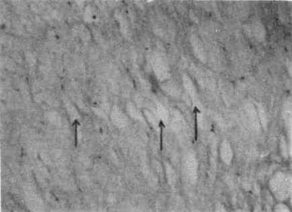 Göbek bağını çevreliyen amnion zarına yakın bölgelerde, damarlar arası bölgelere oranla daha geniş boşluklar görüldü.