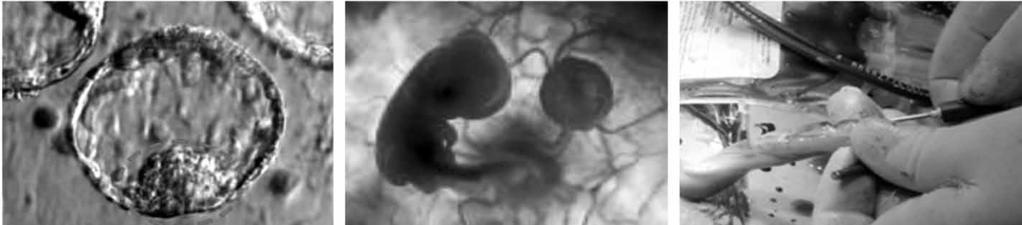 Biyonik Göz ve Oftalmolojide İleri Teknoloji Şekil 6. (a) Erken embriyo dönemindeki blastokist görünümü; (b) Embriyo; (c) Kordon kanının alınması.