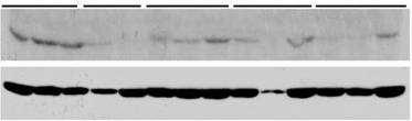 Ang II protein düzeyi Renin mrna düzeyi VDRA ile Böbrekde Renin ve Angiotensin II L C V P L+P yapımının Baskılanması C V L P L+P