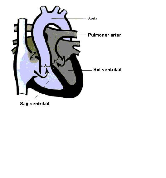2 1- VSD nin sayısı, büyüklüğü, ve lokalizasyonu 2- Sağ ventrikül çıkım yolu obstrüksiyonunun ve pulmoner arter darlığının ciddiyeti 3- Pulmoner arterlerin gelişimi ve dağılımı 4- Koroner arterlerin
