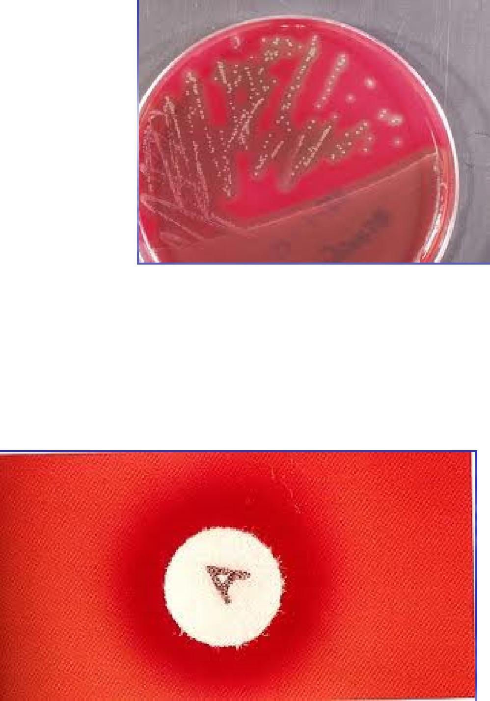 Streptococcus pyogenes Grup A antijeni içerir. S. pyogenes lokal ve sistemik invazyon yapan ve post streptokoksik immünolojik bozukluklara yol açan önemli bir insan patojenidir.