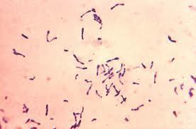Corynebacterium cinsinde bulunan sık rastlanan klinik önemi olan bakteriler Corynebacterium