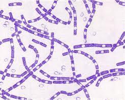 BACILLUS ANTRACIS ÜREME ÖZELLİKLERİ Basit besiyerlerinde bile kolay üreyen fakültatif anaerop bakterilerdir. 18-24 saatte ürerler. Kolonilerin kenarları düzensiz, R şeklindedir.