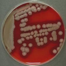 Bacillus anthracis den B.