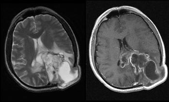 y old male Pre-op