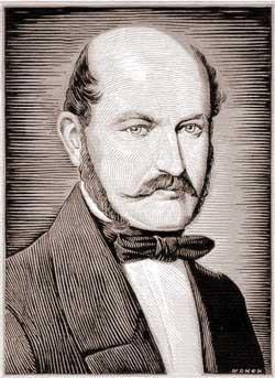 Hastane İnfeksiyonları Ignaz Phillipp Semmelweis, çalıştığı doğum bölümünde; Lohusalık humması sonucu