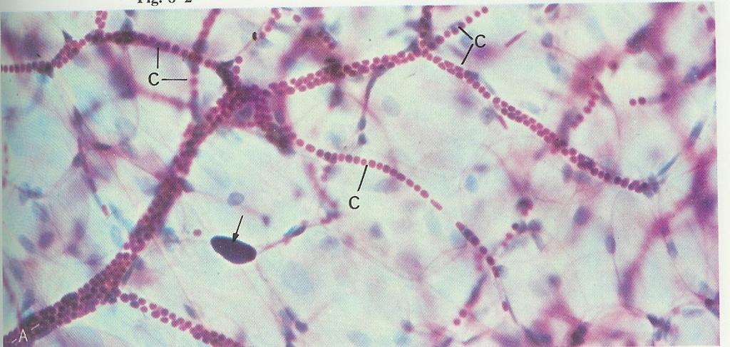 KAPİLLAR DAMARLAR: Kapillarlar arter ve venleri birbirine bağlayan basit endotelial tüplerdir.ortalama 7-9 mikron çapında, 0.25-1 mm uzunluğundadırlar ( normal bir insandaki uzunlukları yaklaşık 96.