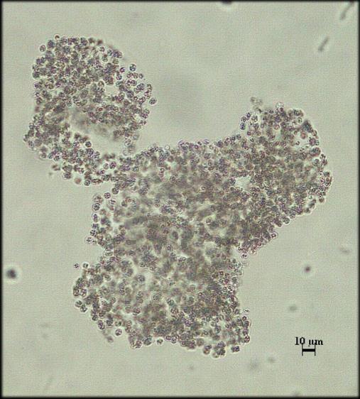 Ordo: Chroococcales Familya: Microcystaceae Genus: Microcystis Lemmermann, 1907 Microcystis aeruginosa (Kützing) Kützing Genç koloni küre şeklinde ya da uzun ve dayanıklı; yaşlı koloni ağ şeklinde ve