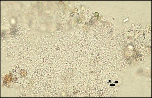 Aphanocapsa grevillei (Berkeley) Rabenhorst 1865 S: Microcystis grevilli (Berkeley) Elenkin 1938 Koloniler serbest halde suda yüzer. Bazen nemli topraklarda yayılış gösterir.