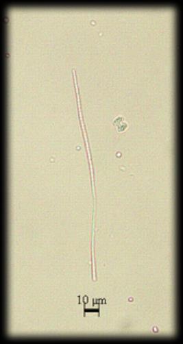 Oscillatoria limnetica Lemmerman 1900 Trikomlar tek başlarına ve planktoniktir veya littoral bölgelerde diğer