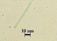Oscillatoria amphibia C.A. Agardh 1827 (S: Pseudanabaena catenula) Trikomlar düzdür ya da kıvrılmıştır. Apekse doğru incelme görülmez. Mavi-yeşil bitki yoğunluğunu oluştururlar.
