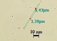 Trikom uzunluğu boyunca bir seri çift granüllü görülen ve her iki tarafında tek granül içeren, karşı hücre duvarlarında daralmamış hücrelerin genişliği (1.5)-2-2.8-(4) µm dir.