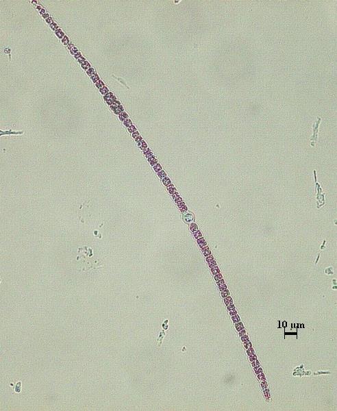 Anabaena catenula Kütz. Ex Bornet et Flahault Trikomlar eğri, düzensizce çevrelenmiş müsilaj kılıflıdır ve mat mavi- yeşil renktedir. Hücrelerden silindir (varil) şekilli olanlar 6.5-8.