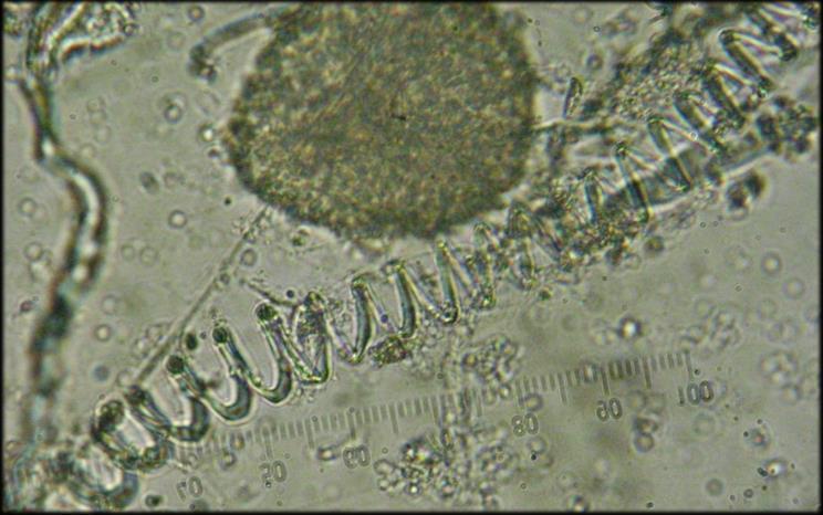 (Schmidle) Anagnostidis & Komárek S: Plectonema notatum Schmidle Serbest yaşayan, tek ya da ince mukuslu ipliklerden oluşur.