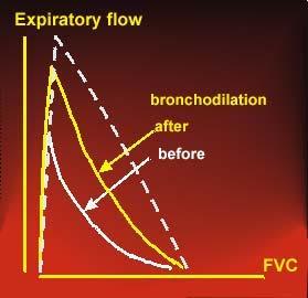 Ekspiratuar akım bronkodilatasyon sonra önce Hacim