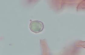µm) RUSSULALES