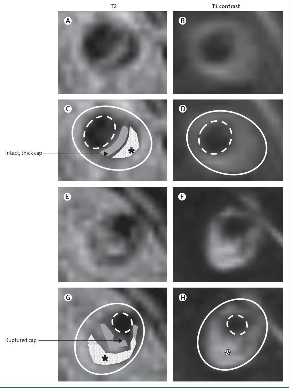 Yüksek Rezolüsyonlu MRI