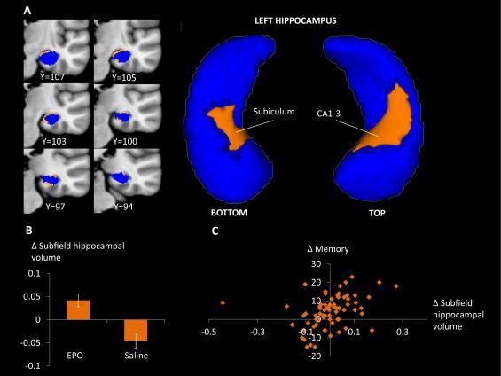 Effects of Erythropoietin on Hippocampal Volume and Memory in Mood Disorders EPO N=30, Kontrol N=34 Kamilla W.