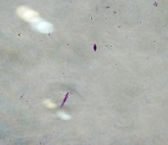 74 Şekil 8.10. UV ışık altında TiO2 nanopartiküllerine maruz kalan parazitlerin mikroskobik görüntüsü (Giemsa, 100X) 8.6.