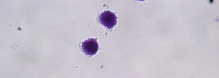 16) TiO2 nanopartiküllerine maruz kalmış parazitlerin makrofajları enfekte