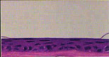 Yine tavşan gözlerinde yapılan başka bir histolojik çalışmada santral epitelyal hücrelerde sayısal değişiklik olmaksızın kısalma ve küçülme olduğu belirlenmiştir (26) (Şekil 5.2a ve 5.2b). Şekil 5.