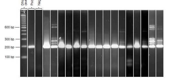 MolParLab Toxoplasma gondii İçiçe PCR