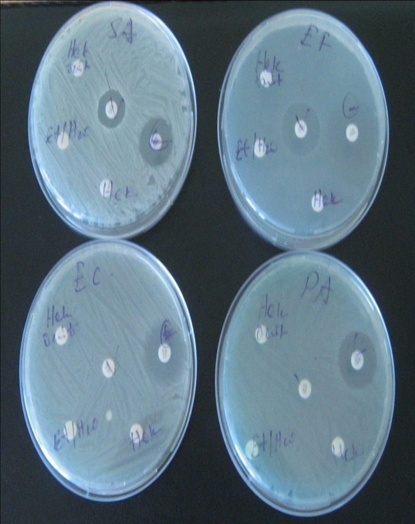 Deney Sonucu Staphylococcu s aereus (MIC mm) Enterococcus faecalis (MIC mm) Escherichia coli (MIC mm) Pseudomonas aeruginos