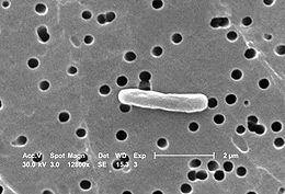 Kullanılan Bakteriler Staphylococcus aureus(s.a): Sporsuz ve hareketsiz kök formundaki bu bakteri Gram pozitif özelliktedir. 30-37ºC de gelişir. Escherichia Coli (E.