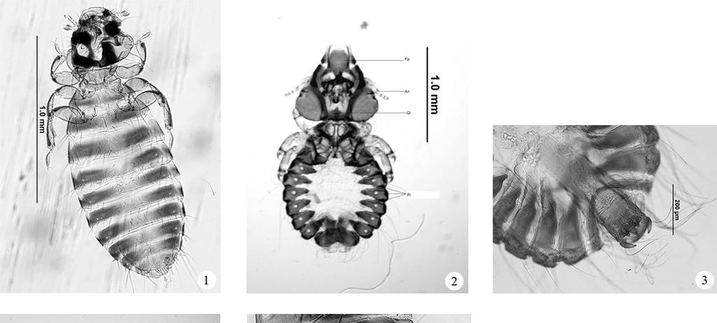 Kanatlılarda bit türleri Şekiller 1.Colpocephalum impressum,dişi (orijinal) 2. Craspedorrhynchus fraterculus,dişi (orijinal); 3. Craspedorrhynchus fraterculus, erkek genitalia (orijinal); 4.