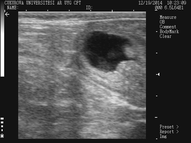 aralığı, parametrelerinin yanında ilk uygulama günü ovaryum bulguları, doğum şekilleri, laktasyon