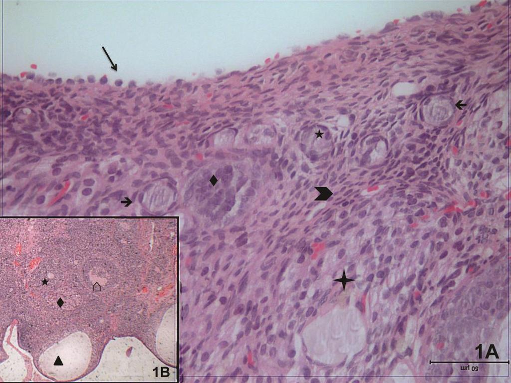Resim 1A,B. Kontrol grubuna ait resimlerde stromada ( ) yaygın stromal hücreler, primer folliküllerin ( ) yanı sıra atretik folliküller ( ) ve korpus luteum ( ) izleniyor.