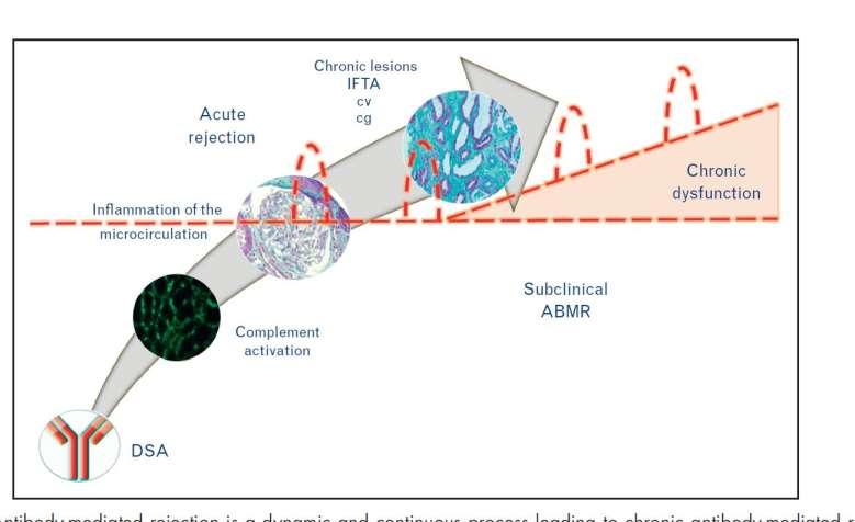 Humoral Teori New insights in antibody-mediated