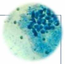 Mikrobiyolojik inceleme İlk Sonuçlar: PNL (+) Rotavirus ve Adenovirus: Negatif C.